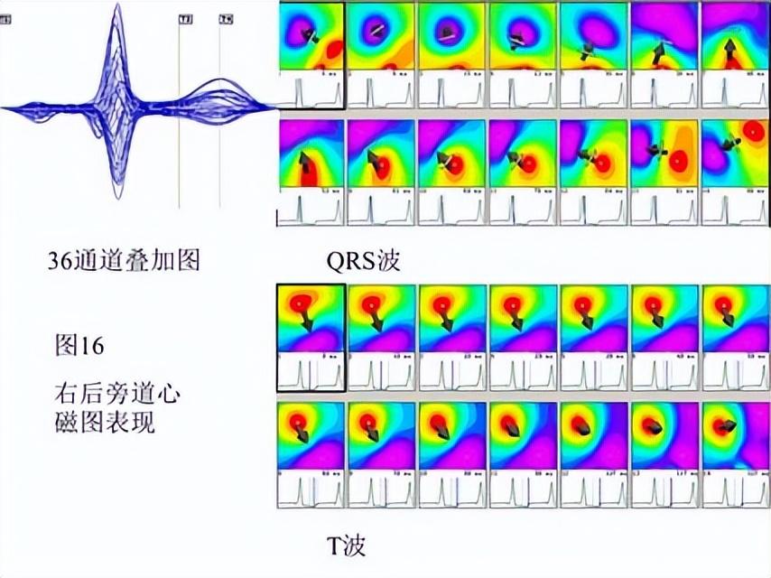 6a9d01b4c0724fb9a6e6b71b0ed61a59~noop.image?_iz=58558&from=article.pc_detail&lk3s=953192f4&x-expires=1717824754&x-signature=RTF7MlZIVJTIkE56udM1p5EgX90%3D